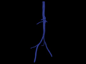 Aortofemoral 3D Model