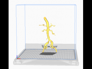 Aortofemoral 3Dモデル