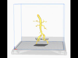 Aortofemoral 3D Model