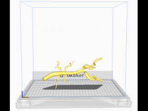 Aortofemoral 3Dモデル