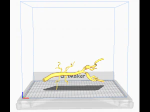 Aortofemoral 3D Model