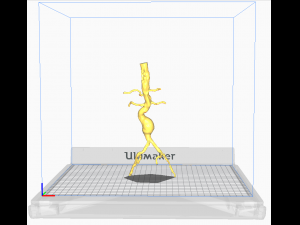 Aortofemoral Modèle 3D
