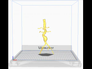 Aortofemoral 3D Model