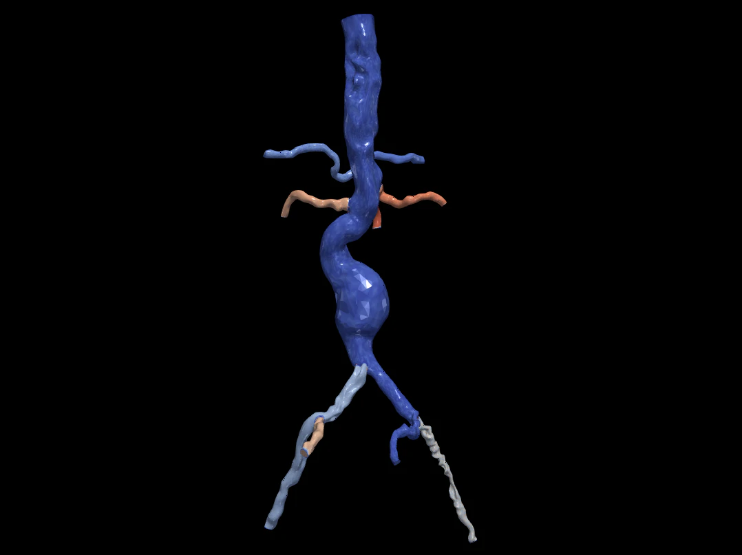 Aortofemoral 3D Model .c4d .max .obj .3ds .fbx .stl .blend