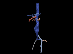 Aortofemoral Modèle 3D