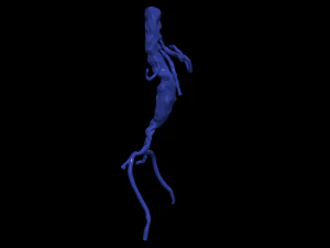 Aortofemoral 3D Model