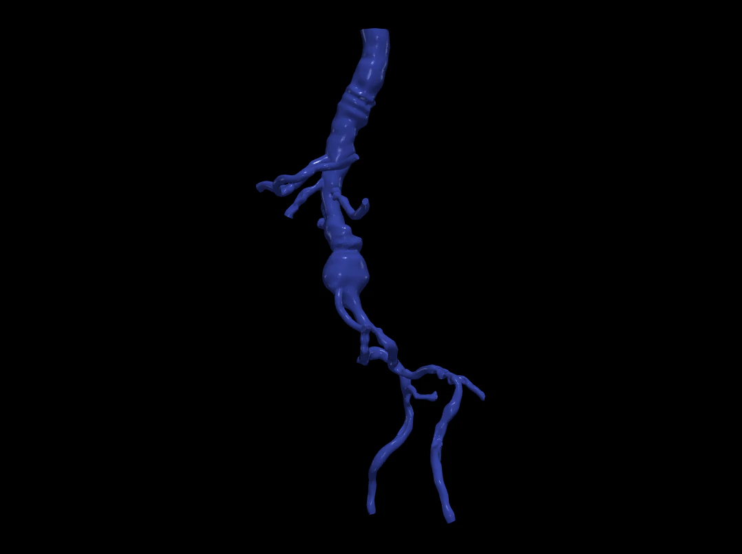 Aortofemoral 3D Model .c4d .max .obj .3ds .fbx .stl .blend 