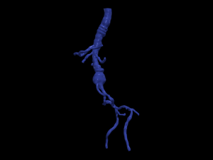 Aortofemoral 3D Model