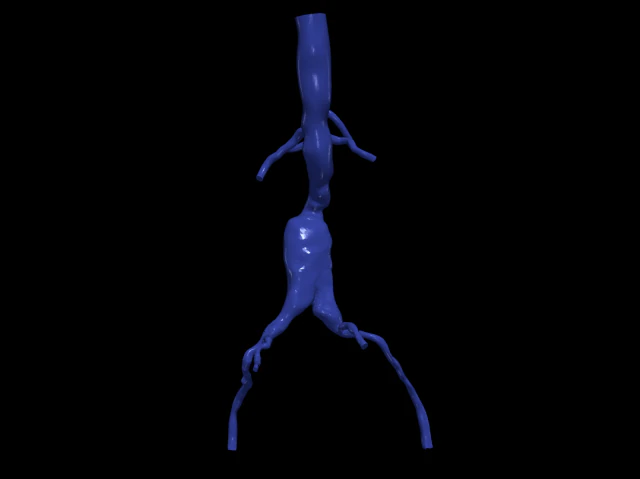 Aortofemoral 3D Modell .c4d .max .obj .3ds .fbx .stl .blend 