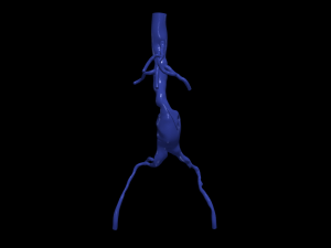 Aortofemoral Model 3D