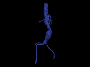 Aortofemoral Model 3D