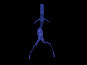 Aortofemoral Model 3D