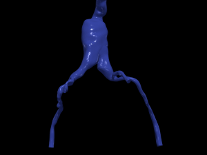 Aortofemoral Model 3D