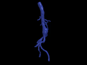 Aortofemoral 3D Model