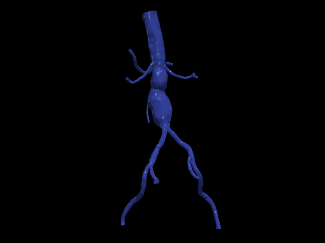 股主动脉 3D 模型 .c4d .max .obj .3ds .fbx .stl .blend 