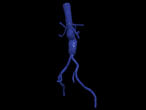 股主动脉 3D 模型