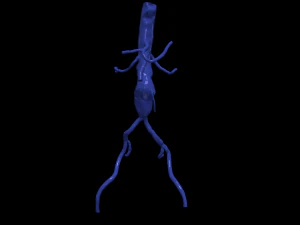 股主动脉 3D 模型