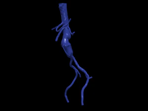 股主动脉 3D 模型