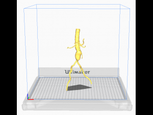 Aortofemoral 3D Model