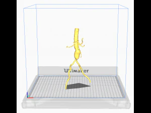 股主动脉 3D 模型