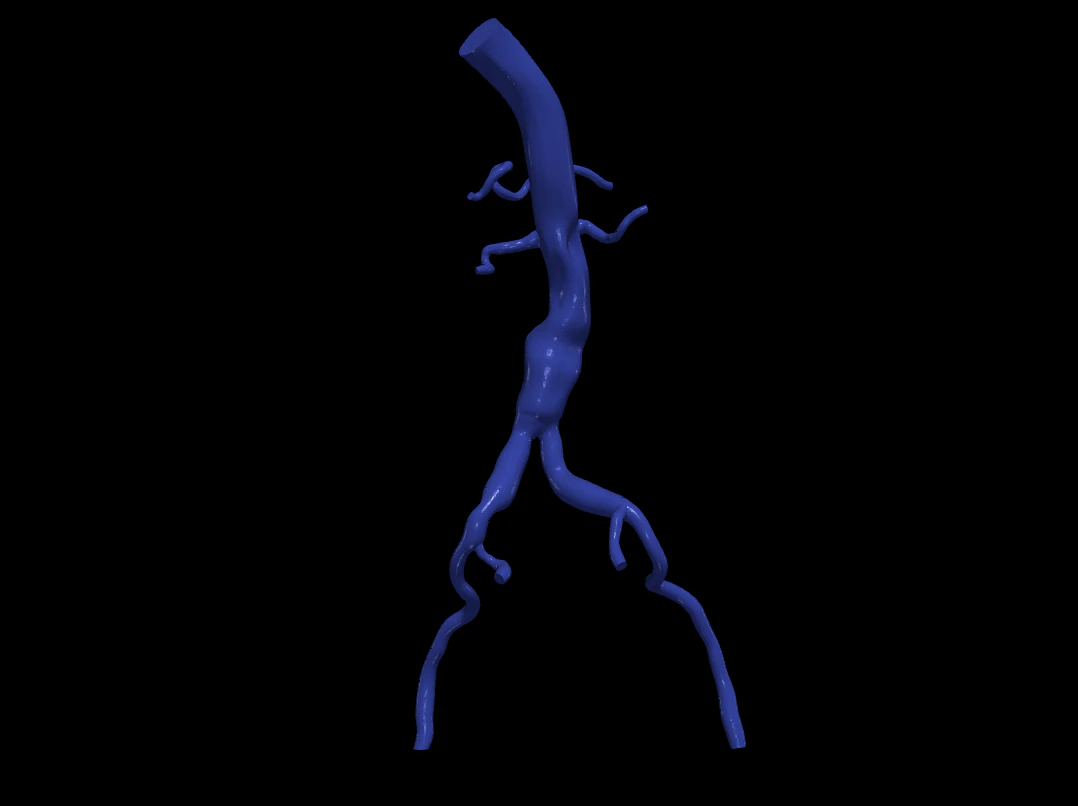 Aortofemoral 3D Model .c4d .max .obj .3ds .fbx .stl .blend 
