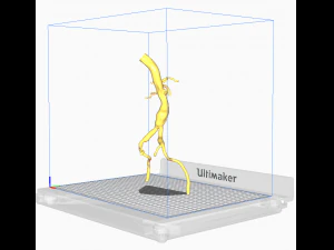 Aortofemoral 3D Model