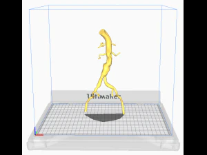 Aortofemoral 3D Model