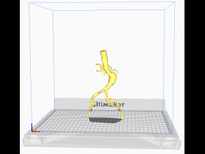 Aortofemoral Modello 3D