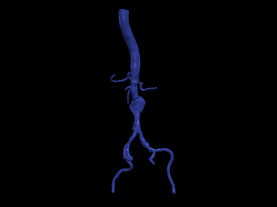 Aortofemoral 3D Model .c4d .max .obj .3ds .fbx .stl .blend 