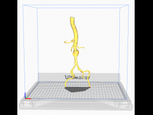 Aortofemoral Modèle 3D