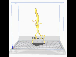 Aortofemoral 3D Model