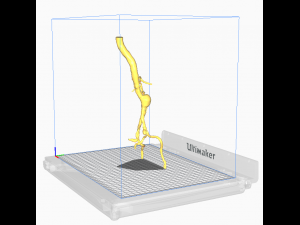 Aortofemoral Modèle 3D