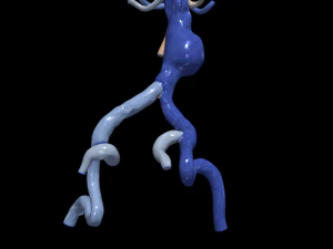 Aortofemoral 3D Modell