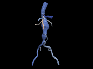 Aortofemoral 3D Модель