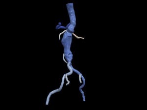 Aortofemoral 3D Модель