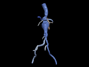 Aortofemoral 3D Модель