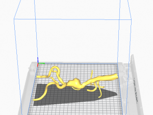 Aortofemoral 3D 模型