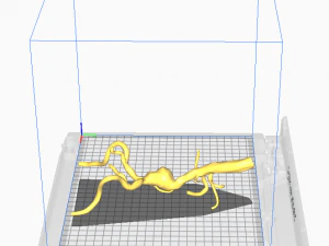 Aortofemoral 3D Modell