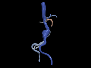 Aortofemoral Model 3D