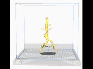 Aortofemoral Model 3D