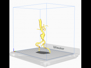Aortofemoral Model 3D