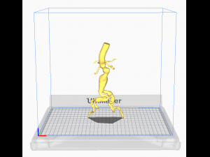 Aortofemoral 3D Model