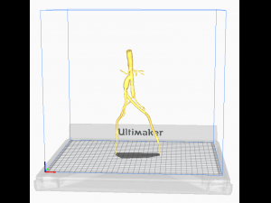 Aortofemoral Modelo 3D