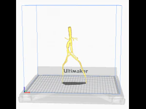 Aortofemoral 3D Model