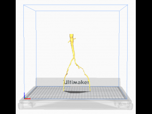 Aortofemoral 3D Model