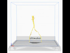 Aortofemoral 3D Model