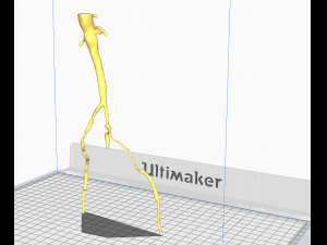 Aortofemoral 3D Model