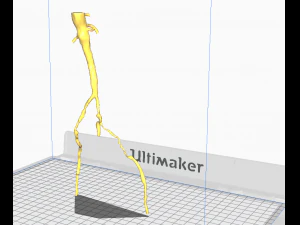 Aortofemoral 3D Model