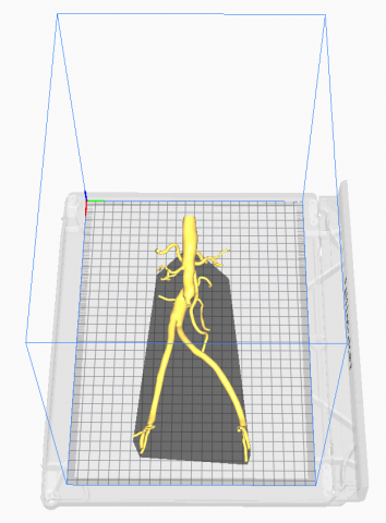 Aortofemoral Modelo 3D .c4d .max .obj .3ds .fbx .stl .blend 