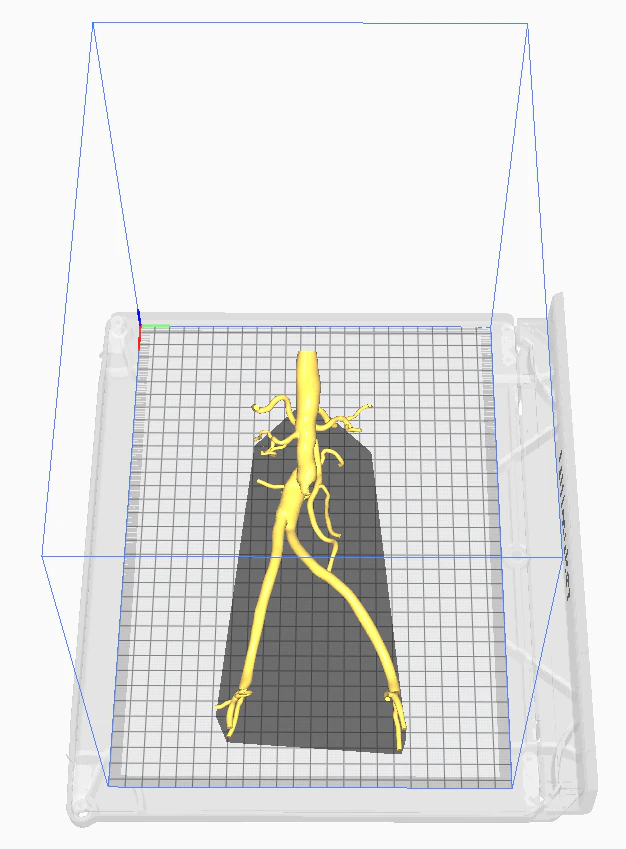 Aortofemoral 3D Model .c4d .max .obj .3ds .fbx .stl .blend